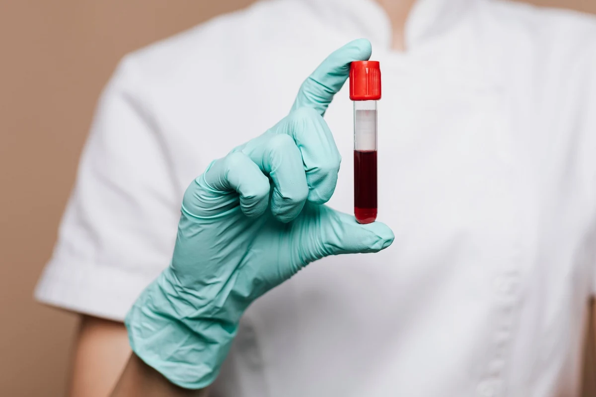 Gloved hand holding a vial of blood for DUI testing